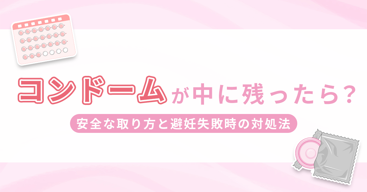 ゴムが中に残ったらどうする？安全な取り方と避妊失敗時の対処法を紹介