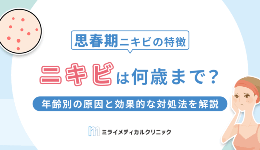ニキビは何歳まで続く？年齢別の原因と効果的な対処法を解説