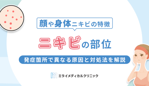 ニキビの部位別！顔や身体の場所で異なる原因と対処法を解説