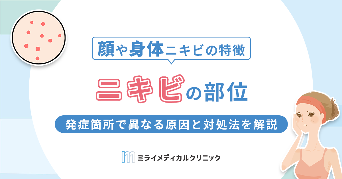 ニキビの部位別！顔や身体の場所で異なる原因と対処法を解説
