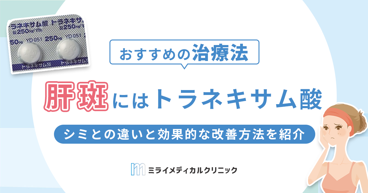 肝斑にはトラネキサム酸がおすすめ！シミとの違いと効果的な改善方法を紹介