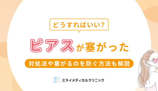 ピアスが塞がった！自分でできる対処法や塞がるのを防ぐ方法も紹介
