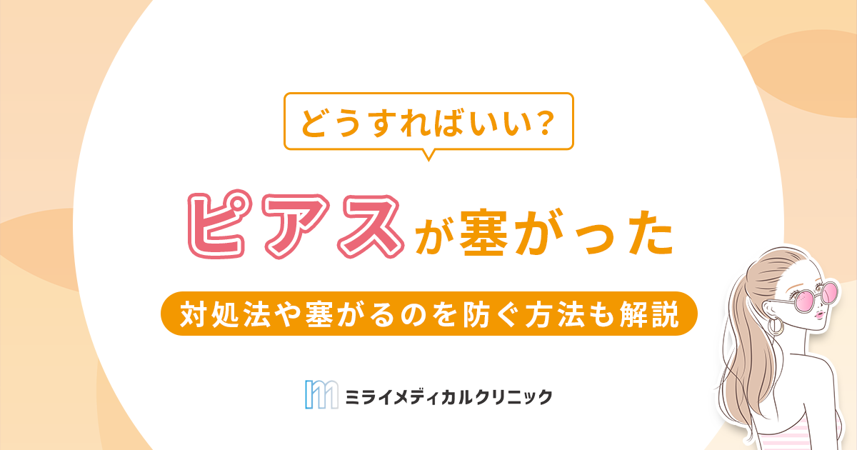 ピアスが塞がった！自分でできる対処法や塞がるのを防ぐ方法も紹介