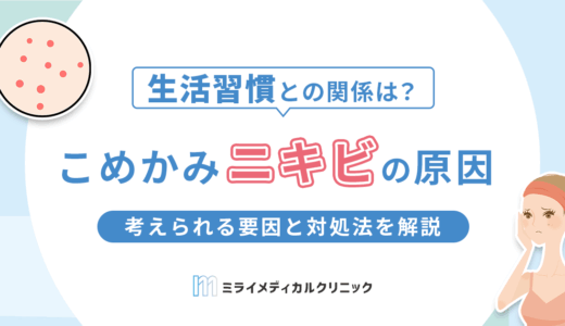 こめかみにニキビができる原因とは？考えられる要因と対処法を解説