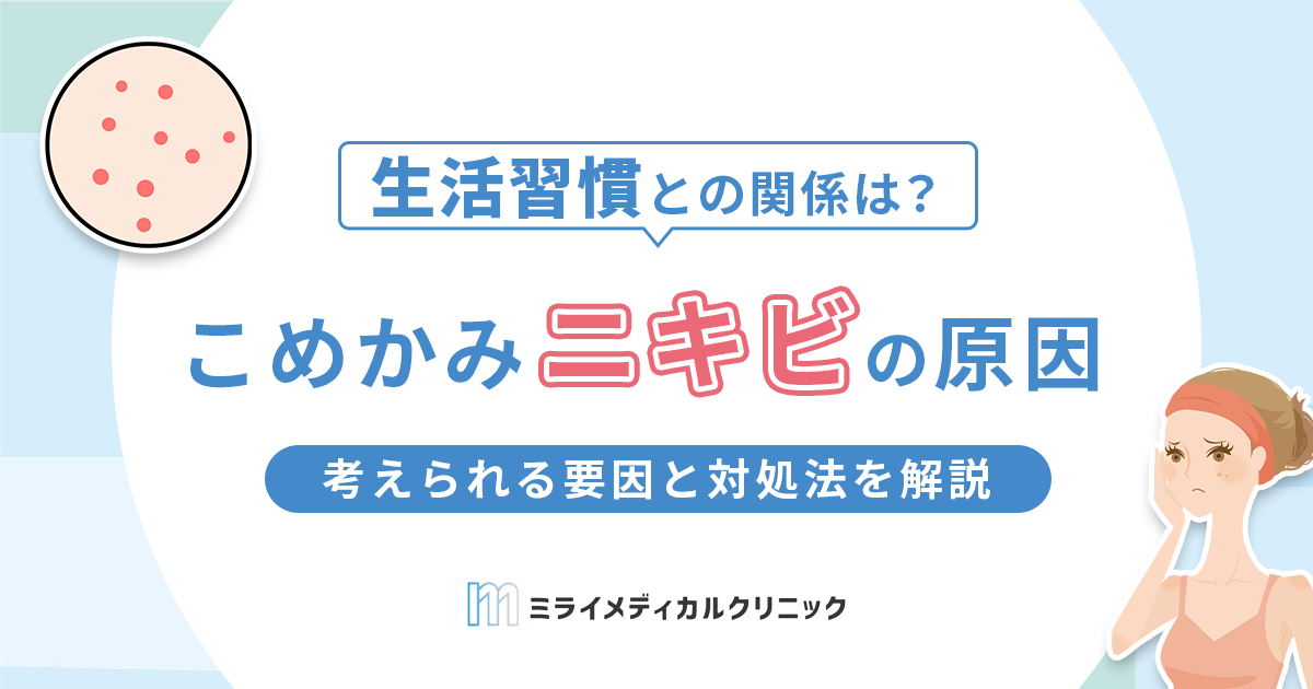 こめかみにニキビができる原因とは？考えられる要因と対処法を解説