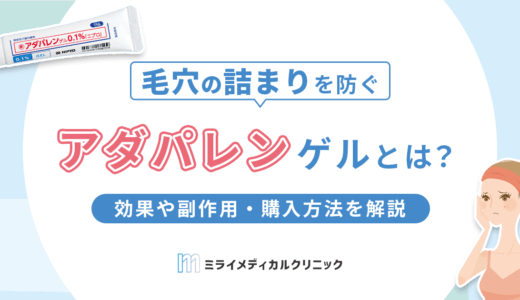 アダパレン ゲルとは？効果や副作用・購入方法をわかりやすく解説