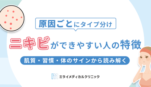 ニキビができやすい人の特徴とは？肌質・習慣・体のサインから読み解く原因と対策法