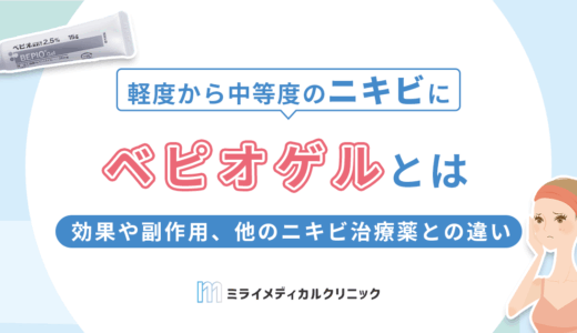 ベピオゲルとは？効果や副作用、他のニキビ治療薬との違いを解説